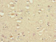 GRIK3 / GLUR7 Antibody - Immunohistochemistry of paraffin-embedded human brain tissue at dilution 1:100