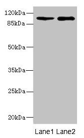 GRIK3 / GLUR7 Antibody - Western blot All lanes: GRIK3 antibody at 1.45µg/ml Lane 1: Hela whole cell lysate Lane 2: K562 whole cell lysate Secondary Goat polyclonal to rabbit IgG at 1/10000 dilution Predicted band size: 105, 99 kDa Observed band size: 105 kDa