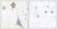 GRIK3 / GLUR7 Antibody - Peptide - + Immunohistochemical analysis of paraffin-embedded human brain tissue using GluR7 antibody.