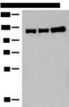 GRIK3 / GLUR7 Antibody - Western blot analysis of Human cerebella tissue Human cerebrum tissue and Human fetal brain tissue lysates  using GRIK3 Polyclonal Antibody at dilution of 1:400