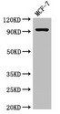 GRIK4 / KA1 Antibody - Positive WB detected in:MCF-7 whole cell lysate;All lanes:GRIK4 antibody at 2.5?g/ml;Secondary;Goat polyclonal to rabbit IgG at 1/50000 dilution;Predicted band size: 108 KDa;Observed band size: 97 KDa;