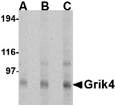 GRIK4 / KA1 Antibody - Western blot of Grik4 in Rat brain tissue lysate with Grik4 antibody at (A) 0.5, (B) 1 and (C) 2 ug/ml.