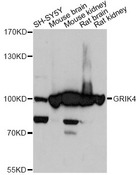 GRIK4 / KA1 Antibody - Western blot analysis of extracts of various cell lines, using GRIK4 antibody at 1:3000 dilution. The secondary antibody used was an HRP Goat Anti-Rabbit IgG (H+L) at 1:10000 dilution. Lysates were loaded 25ug per lane and 3% nonfat dry milk in TBST was used for blocking. An ECL Kit was used for detection and the exposure time was 10s.
