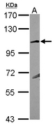 GRIK4 / KA1 Antibody - Sample (30 ug of whole cell lysate) A: MCF-77.5% SDS PAGE GRIK4 antibody diluted at 1:1000