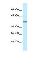 GRIK5 / KA2 Antibody - GRIK5 antibody Western blot of Mouse Pancreas lysate. Antibody concentration 1 ug/ml.  This image was taken for the unconjugated form of this product. Other forms have not been tested.