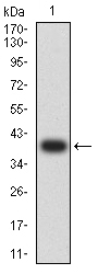 GRIK5 / KA2 Antibody - Western blot analysis using GRIK5 mAb against human GRIK5 (AA: extra 21-166) recombinant protein. (Expected MW is 39 kDa)