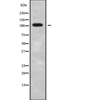 GRIK5 / KA2 Antibody - Western blot analysis GRIK5 using HepG2 whole cells lysates