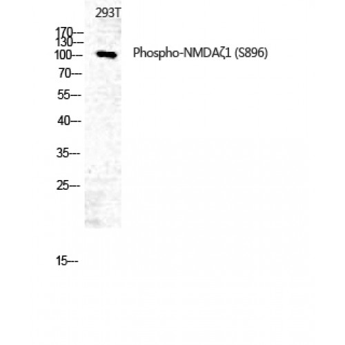 GRIN1 / NMDAR1 Antibody - Western blot of Phospho-NMDAzeta1 (S896) antibody