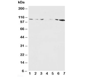 GRIN1 / NMDAR1 Antibody - Western blot testing of NMDAR1 antibody and Lane 1: rat brain; 2: rat brain; 3: rat liver; 4: rat heart; 5: MM453; 6: MM231; 7: HeLa cell lysate