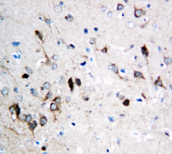 GRIN1 / NMDAR1 Antibody - IHC-P: NMDAR1 antibody testing of rat brain tissue