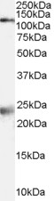 GRIN1 / NMDAR1 Antibody - Antibody (2 ug/ml) staining of Rat Brain lysate (35 ug protein in RIPA buffer). Primary incubation was 1 hour. Detected by chemiluminescence.
