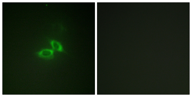 GRIN1 / NMDAR1 Antibody - Immunofluorescence analysis of NIH/3T3 cells, using NMDAR1 Antibody. The picture on the right is blocked with the synthesized peptide.