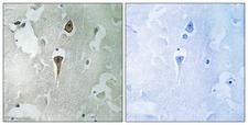 GRIN1 / NMDAR1 Antibody - Immunohistochemistry analysis of paraffin-embedded human brain tissue, using NMDAR1 Antibody. The picture on the right is blocked with the synthesized peptide.