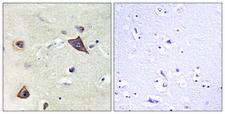 GRIN1 / NMDAR1 Antibody - Immunohistochemistry analysis of paraffin-embedded human brain tissue, using NMDAR1 Antibody. The picture on the right is blocked with the synthesized peptide.