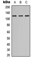 GRIN1 / NMDAR1 Antibody - Western blot analysis of NMDAR1 expression in A549 (A); Y79 (B); Raji (C) whole cell lysates.