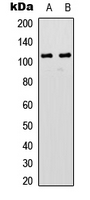GRIN1 / NMDAR1 Antibody - Western blot analysis of NMDAR1 (pS896) expression in HeLa (A); K562 (B) whole cell lysates.