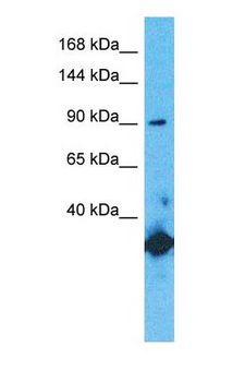 GRIN1 / NMDAR1 Antibody - Western blot of NMDZ1 Antibody with human Fetal Liver lysate.  This image was taken for the unconjugated form of this product. Other forms have not been tested.