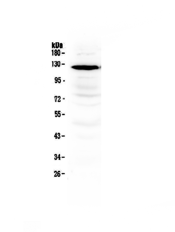GRIN1 / NMDAR1 Antibody - Western blot - Anti-NMDAR1 Picoband antibody