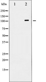 GRIN1 / NMDAR1 Antibody - Western blot analysis of NMDAR1 expression in Jurkat whole cells lysates. The lane on the left is treated with the antigen-specific peptide.