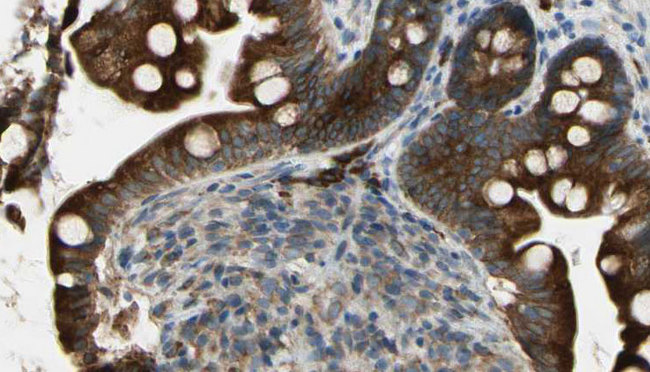GRIN1 / NMDAR1 Antibody - 1:100 staining mouse intestine tissue by IHC-P. The sample was formaldehyde fixed and a heat mediated antigen retrieval step in citrate buffer was performed. The sample was then blocked and incubated with the antibody for 1.5 hours at 22°C. An HRP conjugated goat anti-rabbit antibody was used as the secondary.