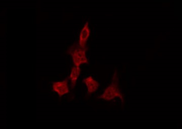 GRIN1 / NMDAR1 Antibody - Staining A549 cells by IF/ICC. The samples were fixed with PFA and permeabilized in 0.1% Triton X-100, then blocked in 10% serum for 45 min at 25°C. The primary antibody was diluted at 1:200 and incubated with the sample for 1 hour at 37°C. An Alexa Fluor 594 conjugated goat anti-rabbit IgG (H+L) Ab, diluted at 1/600, was used as the secondary antibody.
