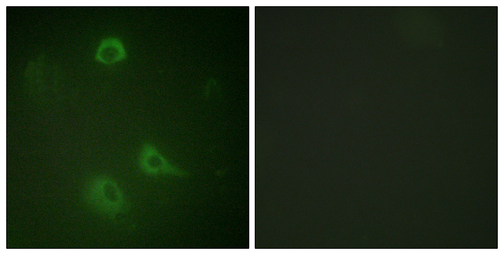 GRIN1 / NMDAR1 Antibody - Immunofluorescence analysis of A549 cells, using NMDAR1 (Phospho-Ser890) Antibody. The picture on the right is blocked with the phospho peptide.