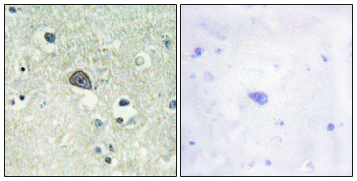 GRIN1 / NMDAR1 Antibody - Immunohistochemistry analysis of paraffin-embedded human brain, using NMDAR1 (Phospho-Ser890) Antibody. The picture on the right is blocked with the phospho peptide.