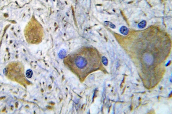 GRIN1 / NMDAR1 Antibody - IHC of p-NMDAR1 (S896)pAb in paraffin-embedded human spinal cord tissue.
