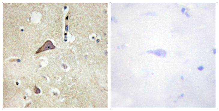 GRIN1 / NMDAR1 Antibody - Immunohistochemistry analysis of paraffin-embedded human brain, using NMDAR1 (Phospho-Ser896) Antibody. The picture on the right is blocked with the phospho peptide.