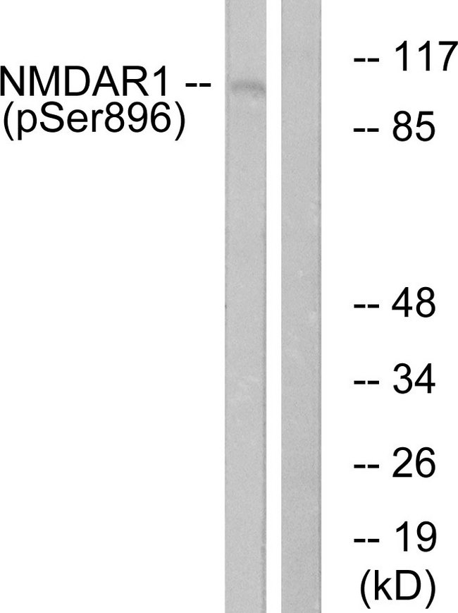 GRIN1 / NMDAR1 Antibody - Western blot analysis of lysates from K562 cells treated with PMA 125ng/ml 30', using NMDAR1 (Phospho-Ser896) Antibody. The lane on the right is blocked with the phospho peptide.