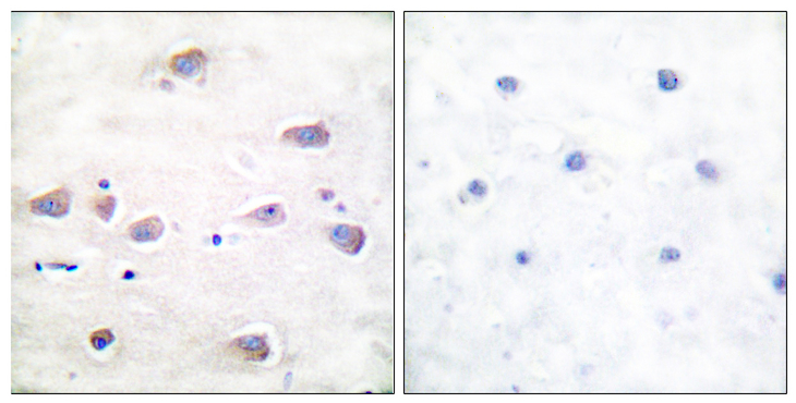 GRIN1 / NMDAR1 Antibody - Immunohistochemistry analysis of paraffin-embedded human brain, using NMDAR1 (Phospho-Ser897) Antibody. The picture on the right is blocked with the phospho peptide.
