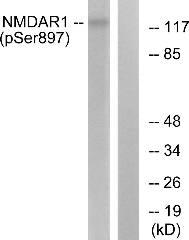 GRIN1 / NMDAR1 Antibody - Western blot analysis of lysates from LOVO cells, using NMDAR1 (Phospho-Ser897) Antibody. The lane on the right is blocked with the phospho peptide.