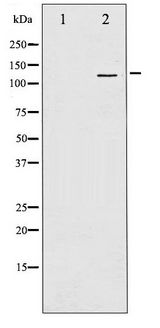 GRIN1 / NMDAR1 Antibody - Western blot of NMDAR1 phosphorylation expression in LOVO whole cell lysates,The lane on the left is treated with the antigen-specific peptide.