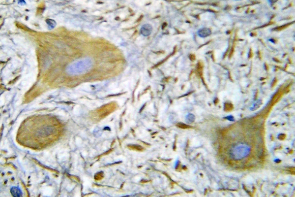 GRIN1 / NMDAR1 Antibody - IHC of NMDAR1 (S902) pAb in paraffin-embedded human spinal cord tissue.