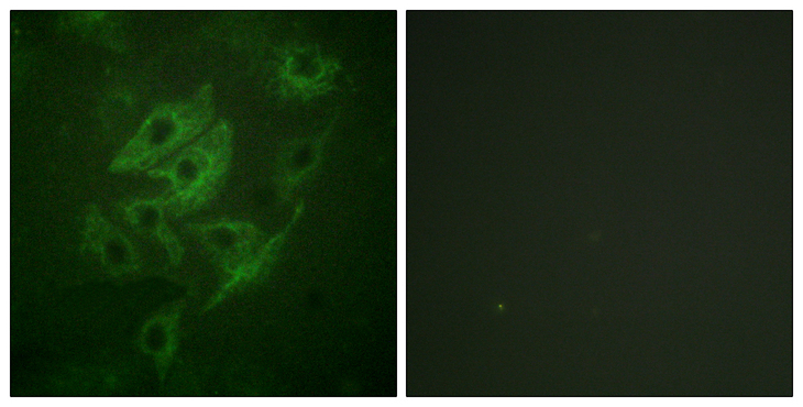 GRIN2A+GRIN2B Antibody - Immunofluorescence analysis of HUVEC cells, using NMDAR2A/B Antibody. The picture on the right is blocked with the synthesized peptide.