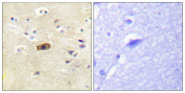 GRIN2A+GRIN2B Antibody - Immunohistochemistry analysis of paraffin-embedded human brain tissue, using NMDAR2A/B Antibody. The picture on the right is blocked with the synthesized peptide.