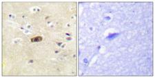 GRIN2A+GRIN2B Antibody - Immunohistochemistry analysis of paraffin-embedded human brain tissue, using NMDAR2A/B Antibody. The picture on the right is blocked with the synthesized peptide.