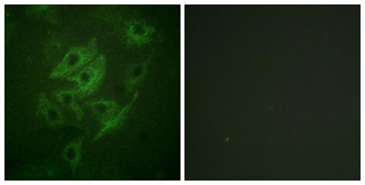 GRIN2A+GRIN2B Antibody - Peptide - + Immunofluorescence analysis of HUVEC cells, using NMDAR2A/B antibody.