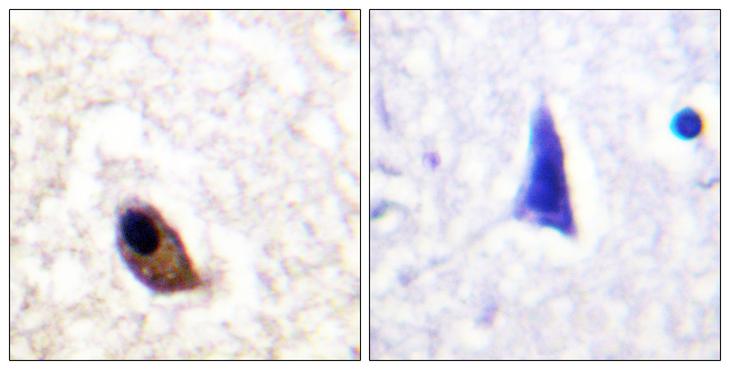 GRIN2A+GRIN2B Antibody - P-peptide - + Immunohistochemistry analysis of paraffin-embedded human brain tissue using NMDA/NR2A/B (Phospho-Tyr1246/1252) antibody.