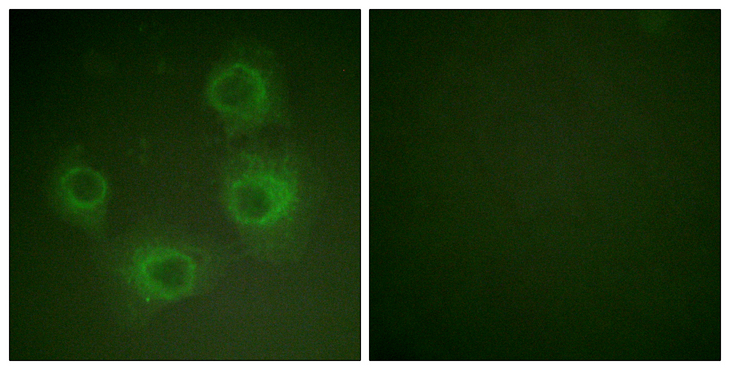 GRIN2A+GRIN2B Antibody - Immunofluorescence analysis of HUVEC cells, using NMDAR2A/B (Phospho-Tyr1246/1252) Antibody. The picture on the right is blocked with the phospho peptide.