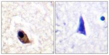GRIN2A+GRIN2B Antibody - Immunohistochemistry analysis of paraffin-embedded human brain, using NMDAR2A/B (Phospho-Tyr1246/1252) Antibody. The picture on the right is blocked with the phospho peptide.