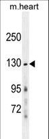 GRIN2A / NMDAR2A / NR2A Antibody - GRIN2A Antibody western blot of mouse heart tissue lysates (35 ug/lane). The GRIN2A antibody detected the GRIN2A protein (arrow).