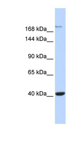 GRIN2A / NMDAR2A / NR2A Antibody - GRIN2A / NMDAR2A antibody Western blot of Fetal Muscle lysate. This image was taken for the unconjugated form of this product. Other forms have not been tested.