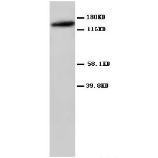GRIN2A / NMDAR2A / NR2A Antibody - WB of GRIN2A / NMDAR2A / NR2A antibody.
