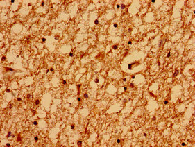 GRIN2A / NMDAR2A / NR2A Antibody - Immunohistochemistry of paraffin-embedded human brain tissue using GRIN2A Antibody at dilution of 1:100