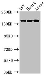 GRIN2A / NMDAR2A / NR2A Antibody - Western Blot Positive WB detected in: U87 whole cell lysate, Rat heart tissue, Mouse liver tissue All lanes: GRIN2A antibody at 3.2µg/ml Secondary Goat polyclonal to rabbit IgG at 1/50000 dilution Predicted band size: 166, 145 kDa Observed band size: 166 kDa