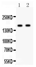 GRIN2A / NMDAR2A / NR2A Antibody - NMDAR2A antibody Western blot. All lanes: Anti NMDAR2A at 0.5 ug/ml. Lane 1: Rat Brain Tissue Lysate at 50 ug. Lane 2: Mouse Brain Tissue Lysate at 50 ug. Predicted band size: 165 kD. Observed band size: 165 kD.