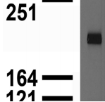 GRIN2A / NMDAR2A / NR2A Antibody - Immunoblotting: use at 1ug/ml. A band of ~170kDa is detected.