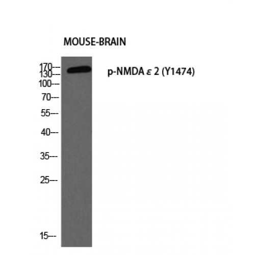 GRIN2B / NMDAR2B / NR2B Antibody - Western blot of Phospho-NMDAepsilon2 (Y1474) antibody