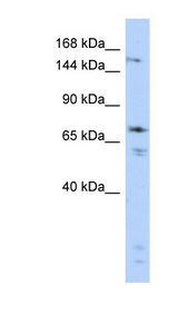 GRIN2B / NMDAR2B / NR2B Antibody - GRIN2B / NMDAR2B antibody Western blot of Fetal Brain lysate. This image was taken for the unconjugated form of this product. Other forms have not been tested.